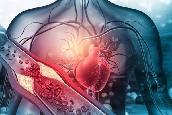 Cardiovascular